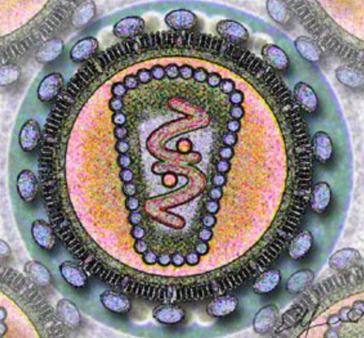 Virus de Inmunodeficiencia Adquirida (VIH)