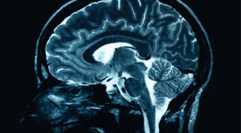 Timeline: Reading In The Brain Chapter 2