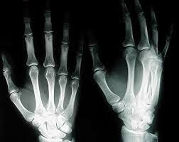 Historia de los rayos X