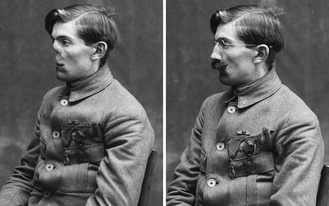 LEY PARA LA REHABILITACIÓN DEL SOLDADO (SMITH-SEARS ACT O SOLDIER´S REHABILITATION ACT) EUA