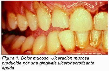 Época de la Concreción (Afirmación) de la Endodoncia(1936-1940)