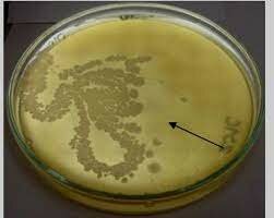 Se introduce en la microbiologia el concepto de antagonismo