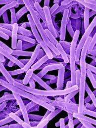 Aislan el bacilo del ántrax