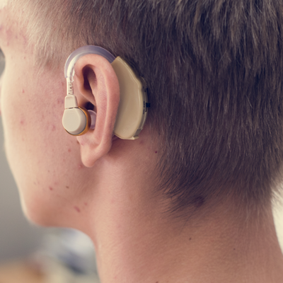 Timeline: Audífono o prótesis auditiva