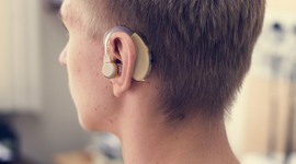 Timeline: Audífono o prótesis auditiva