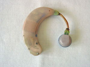 Retro auricular