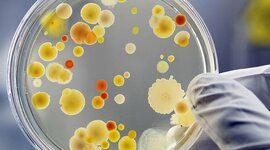 Timeline: Historia de la Microbiología