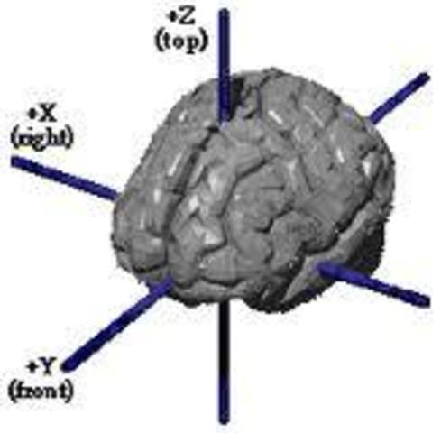 Talairich's Atlas of the Brain Published