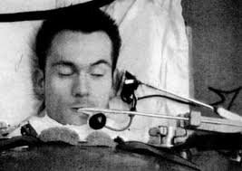 Invención de la ventilación mecánica