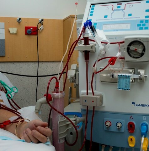 Selección de candidatos para los aparatos de hemodiálisis