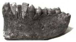 Implantes dentales Fenicia (mediterránea)