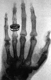 Primera Radiografía