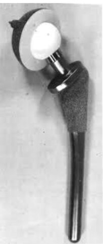 Prótesis de partes cambiantes