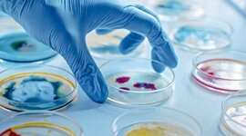 Timeline: Historia de la Mircobiología