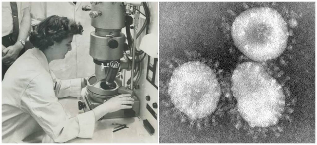 Primera micrografía de los Coronavirus