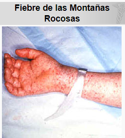 La Enfermedad Y La Superstición