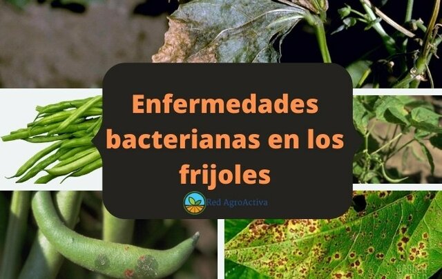 la teoría microbiana sin pasteur y koch