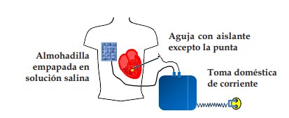 Precursor del marcapasos
