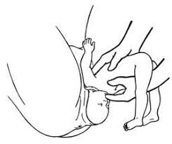 EDAD MODERNA-OBSTETRA REPRESENTATIVO