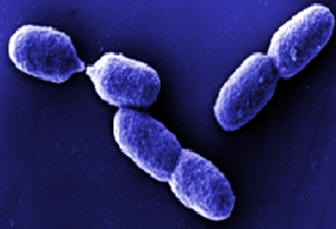 Estudio y producción de híbridos de genes bacterianos por Paul Bergjnnto con D. Jackson y R Symon