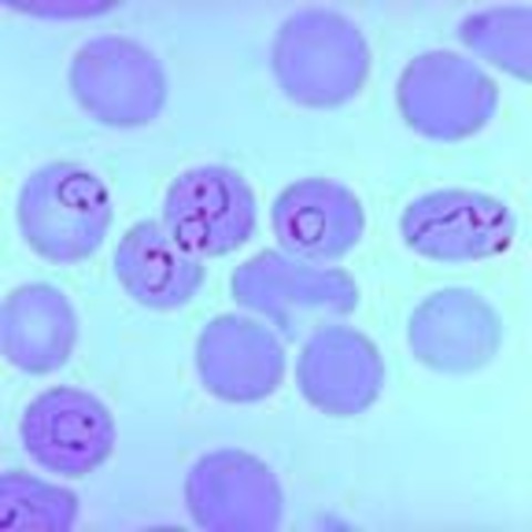 Microbes start resisting penicillin