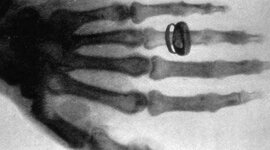 Timeline: Eventos importantes en la historia de la radiologia