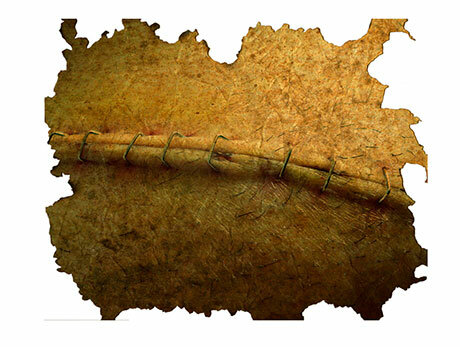 Cráneos fósiles trepanados y con signos de cicatrización ósea