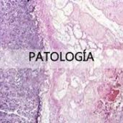 Timeline: PATOLOGIA