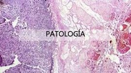 Timeline: PATOLOGIA