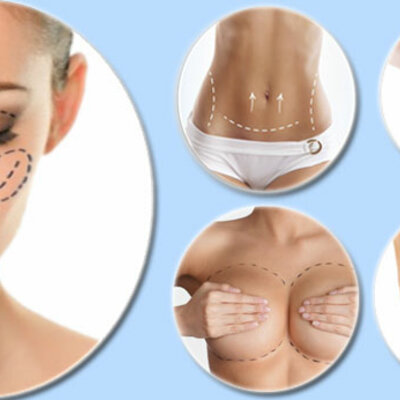 Timeline: HISTORIA DE LA CIRUGÍA PLÁSTICA