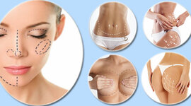 Timeline: HISTORIA DE LA CIRUGÍA PLÁSTICA