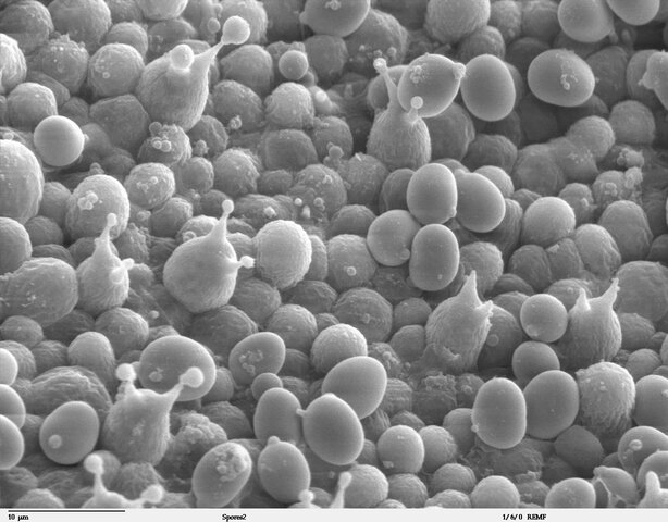 La teoría Microbiana Sin Pasteur y Koch