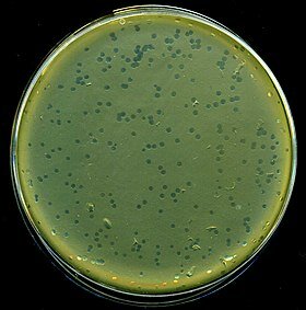 DESCUBRIMIENTO DEL VIRUS BACTERIOFAGO λ