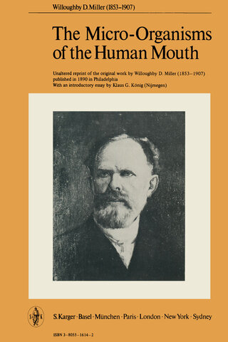 Factores Causantes de la caries dental