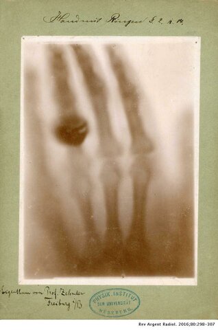 Descubrimiento de los Rayos X