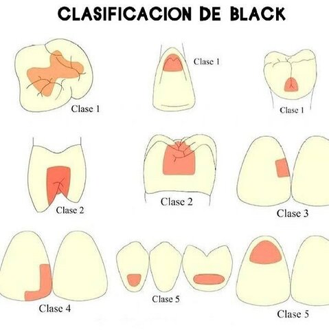 Clasificación de Black