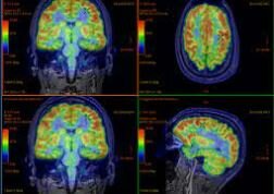 APLICACIONES DESDE 1895 HASTA NUESTROS DÍAS DE LA RADIACIÓN IONIZANTE EN TERAPIA