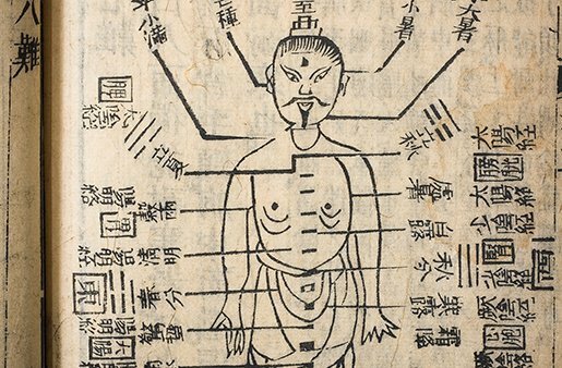 En China se inicia la acupuntura, técnica que subsiste hasta nuestros días