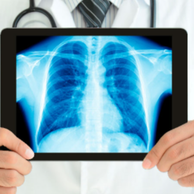 Timeline: Radiología y radio protección