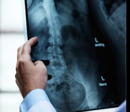 Comité internacional de protección radiológica