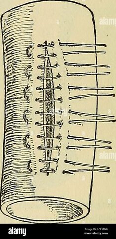 Desarrollo y estudio de materiales para suturas