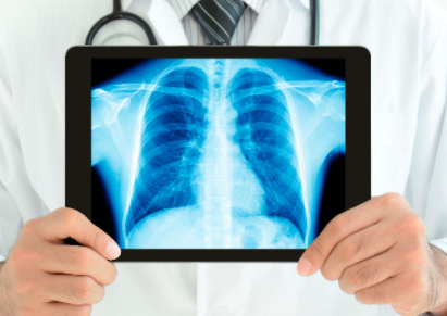 Aplicaciones desde 1895 hasta nuestros días de la radiación  ionizante en diagnóstico