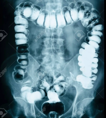 Aplicaciones desde 1895 hasta nuestros días de la radiación  ionizante en diagnóstico
