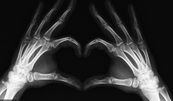 Aplicaciones desde 1895 hasta nuestros días de la radiación  ionizante en terapia