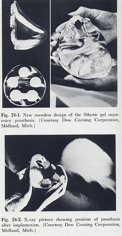 Primeros implantes mamarios
