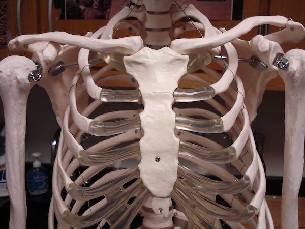 Desarrollo de implantes óseos