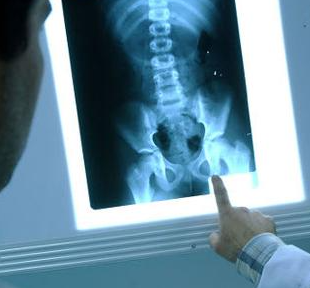 Radiactividad natural y artificial