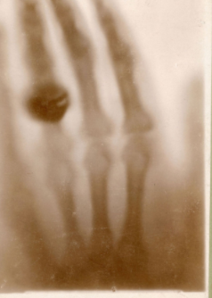 Estructura y modelos del tubo de rayos x