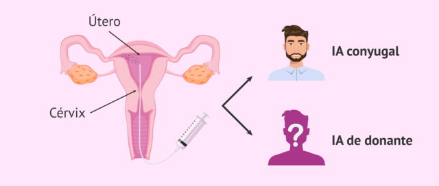 John J. Zhang - Método de reproducción asistida