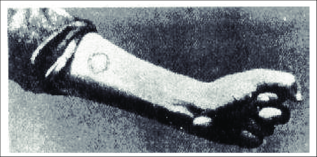 Efectos biológicos de la radiación